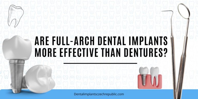 Are full-arch dental implants more effective than dentures