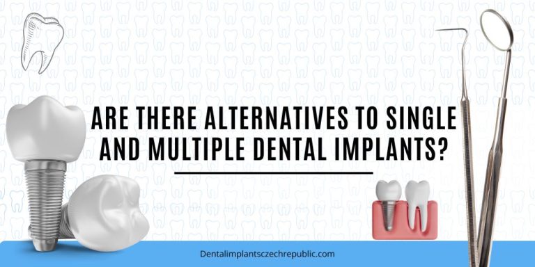Are there alternatives to single and multiple dental implants
