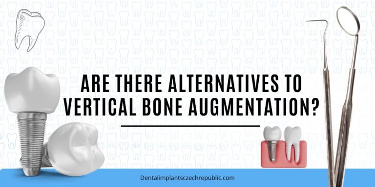 Are there alternatives to vertical bone augmentation