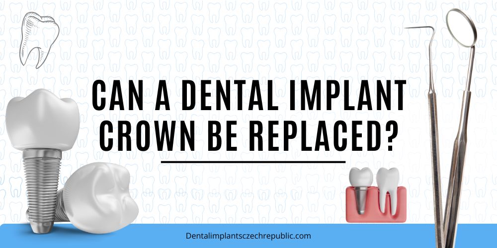Can a dental implant crown be replaced