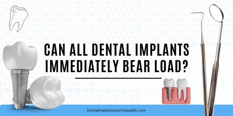 Can all dental implants immediately bear load