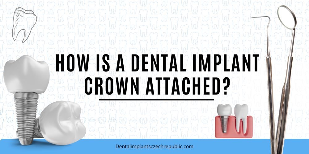 How is a dental implant crown attached