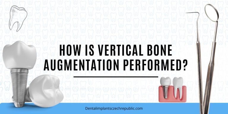 How is vertical bone augmentation performed