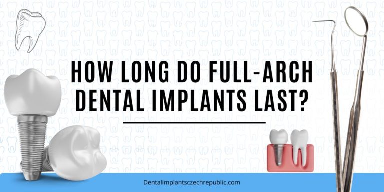 How long do full-arch dental implants last