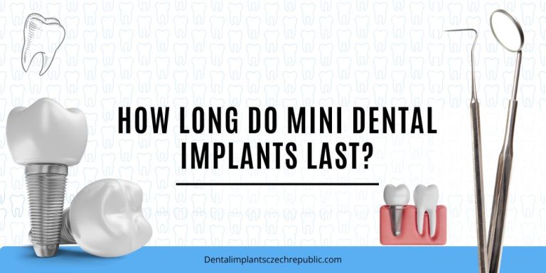 How long do mini dental implants last