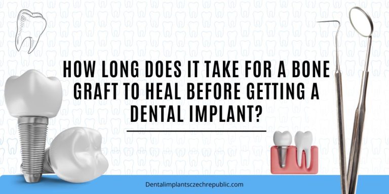 How long does it take for a bone graft to heal before getting a dental implant