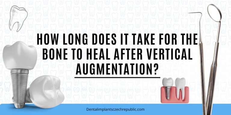 How long does it take for the bone to heal after vertical augmentation