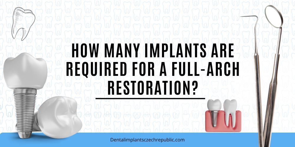 How many implants are required for a full-arch restoration