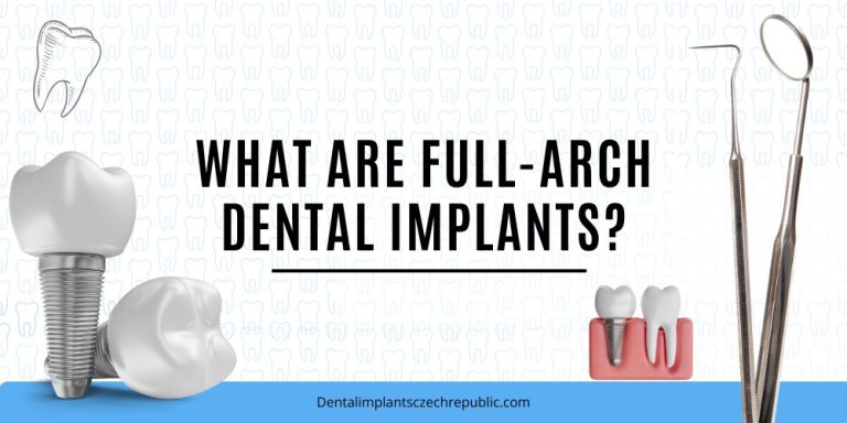 What are full-arch dental implants