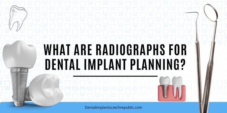 What are radiographs for dental implant planning