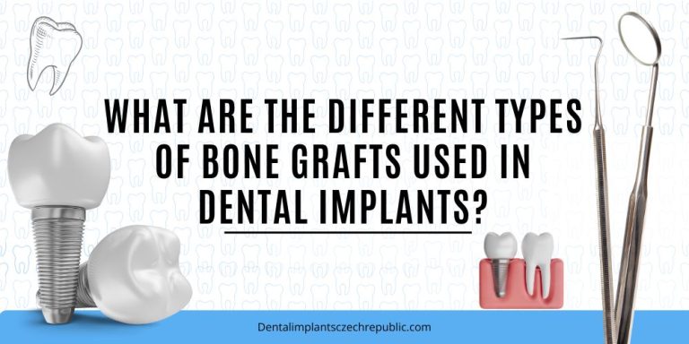 What are the different types of bone grafts used in dental implants