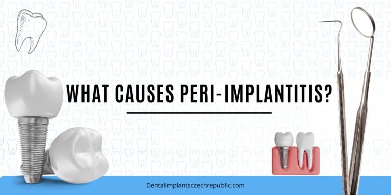 What causes peri-implantitis