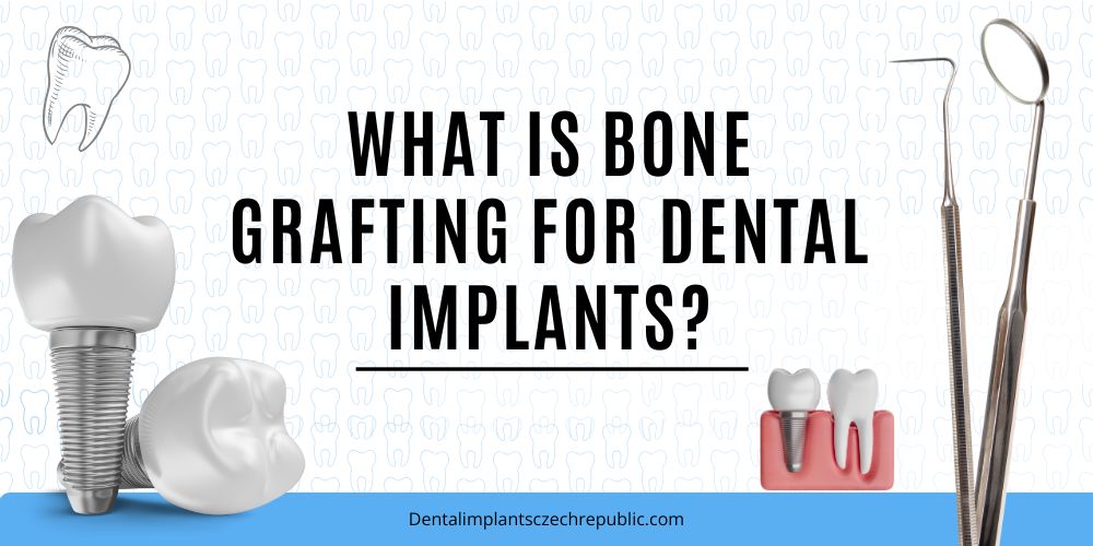 What is Bone Grafting for Dental Implants