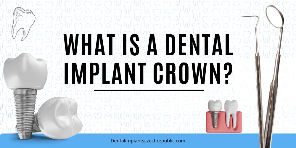 What is a Dental Implant Crown