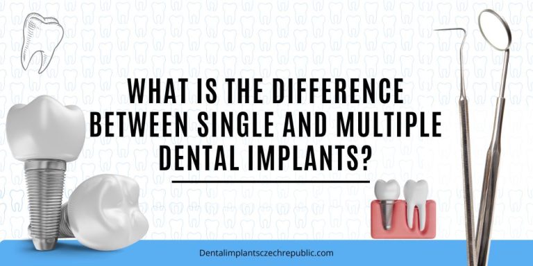 What is the difference between single and multiple dental implants
