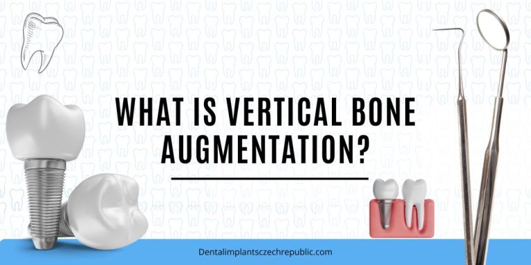 What is vertical bone augmentation