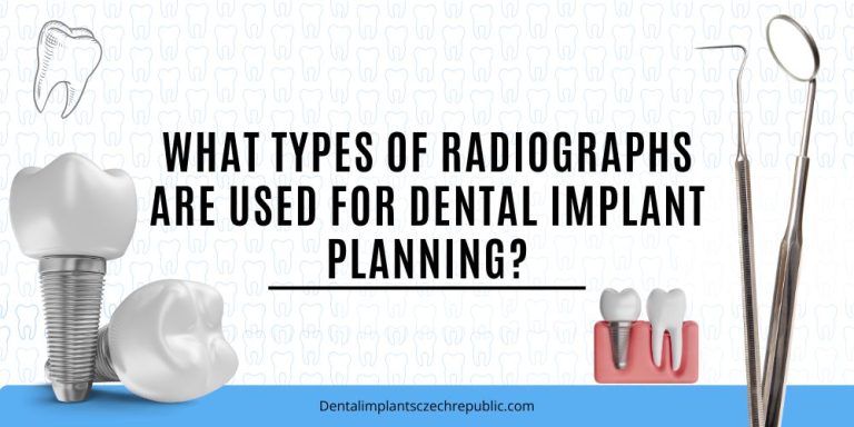 What types of radiographs are used for dental implant planning